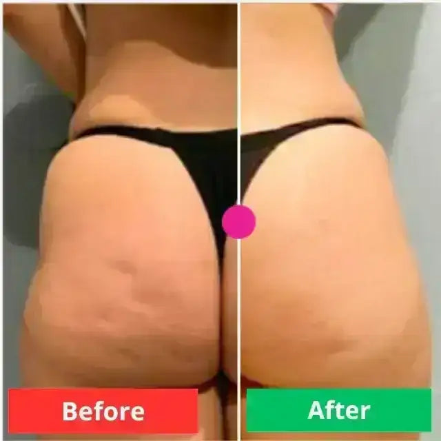 Crema ADEUS  con efecto comprobado en la firmeza de la piel