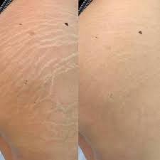Crema ADEUS  con efecto comprobado en la firmeza de la piel